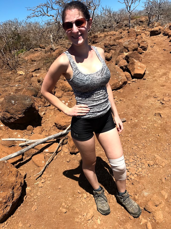 Knowing that this is a physically demanding trip is one of the most important tips for visiting the Galápagos Islands. Here is a picture of me with a sprained knee I got from hitting it on a rock while snorkeling. 